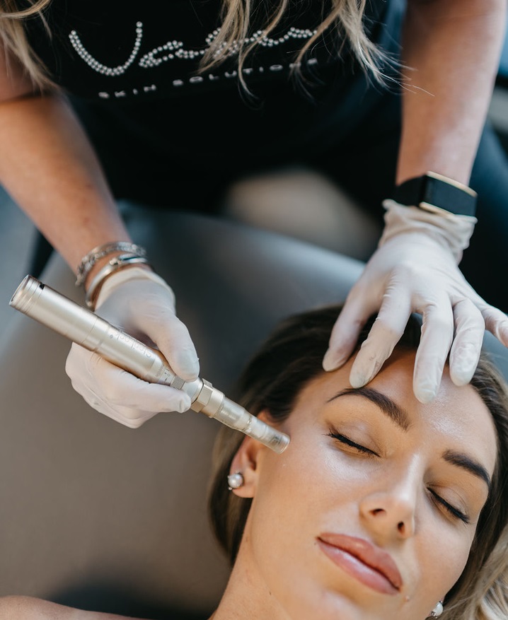 Jen giving acne laser treatment to woman lying on table
