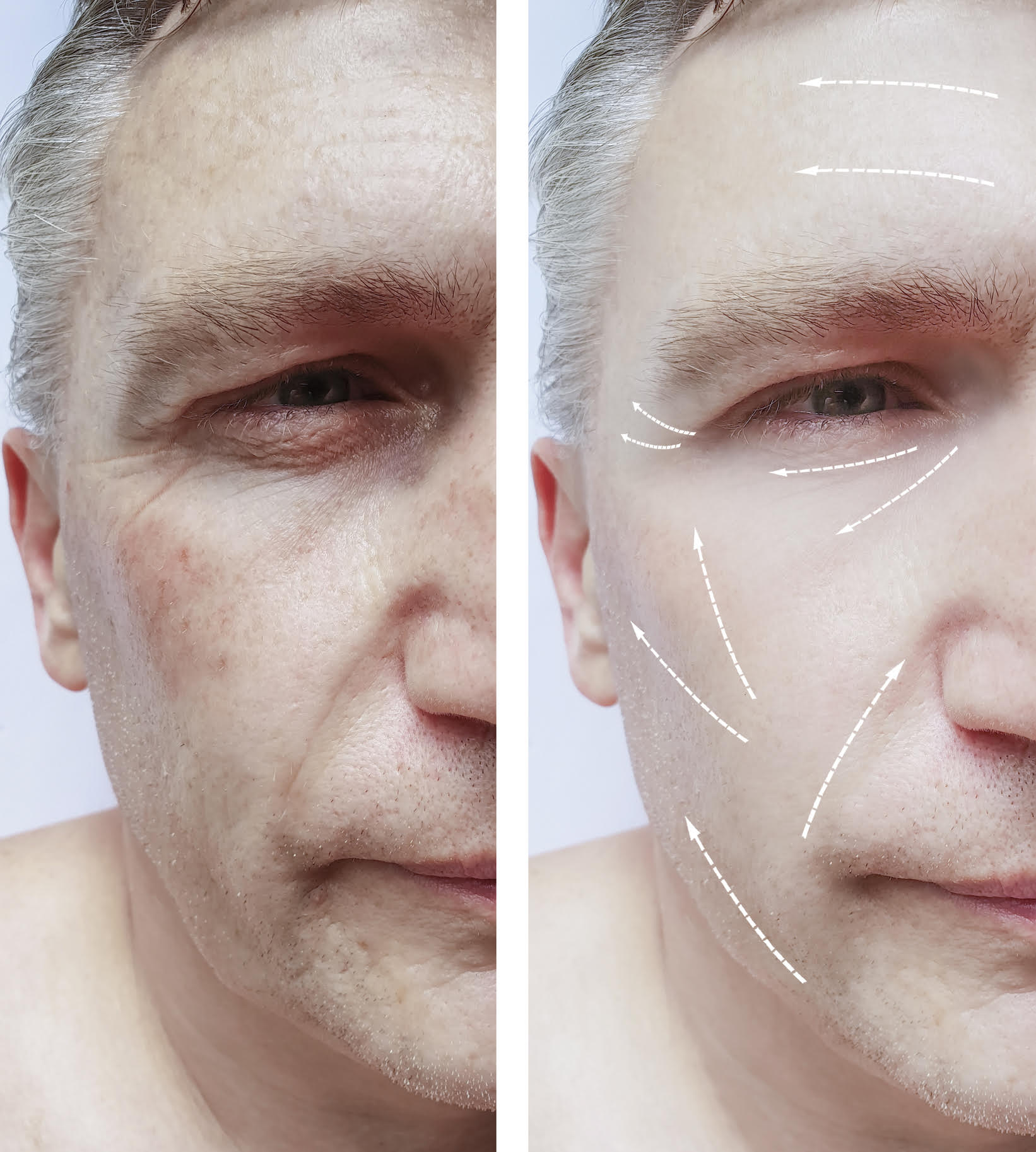 Man showing pigmented skin